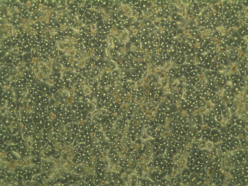 Hepatocytes