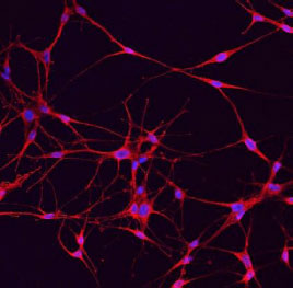 Mel-5 stained adult melanocytes