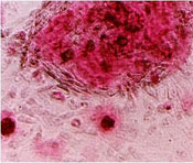 Differentiated Adult Stem Cells Figure 2