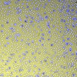 Microscope Photograph of Human Keratinocytes