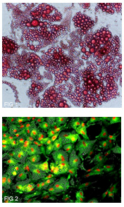 Microscope Photograph of Subcutaneous Adipocytes