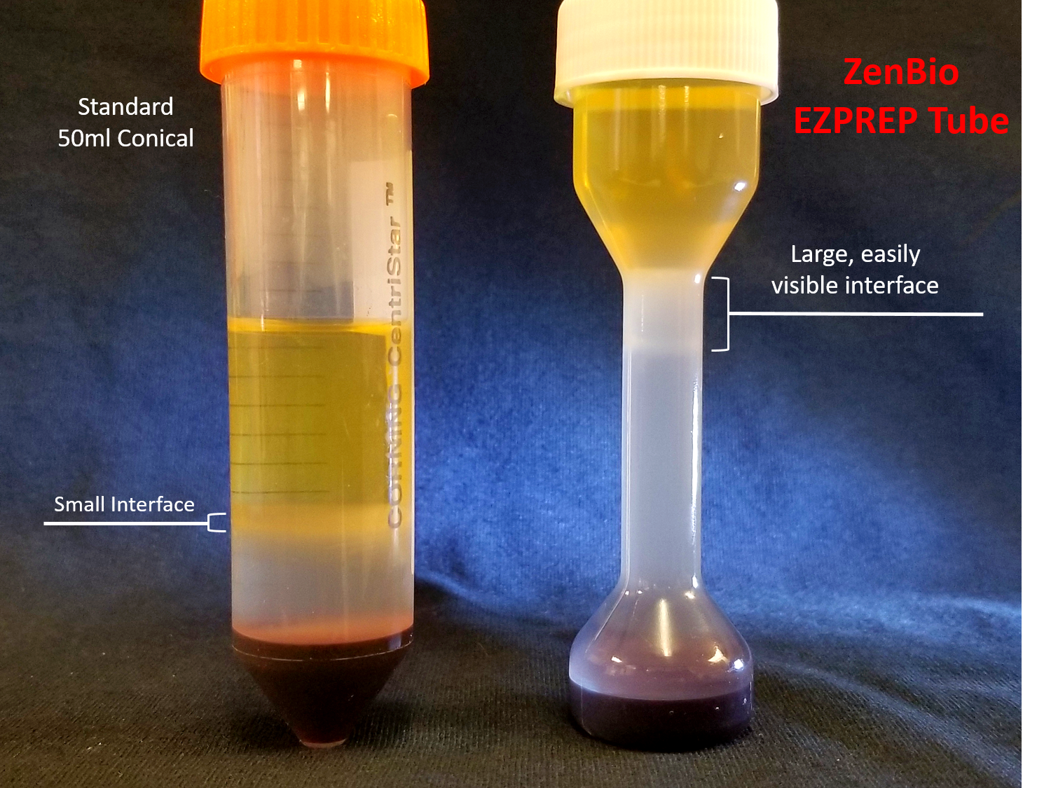 EZPREP Peripheral Blood Mononuclear Cell Isolation Kit