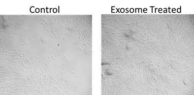 Human Exosomes Control and Treated Photograph