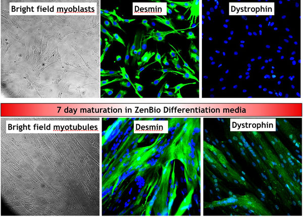 Skeletal Myocytes