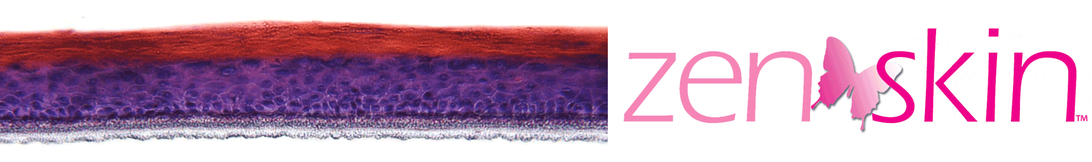 Reconstructed Human Epidermis